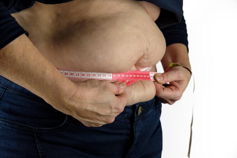 How To Get Rid Of Hanging Belly After C Section